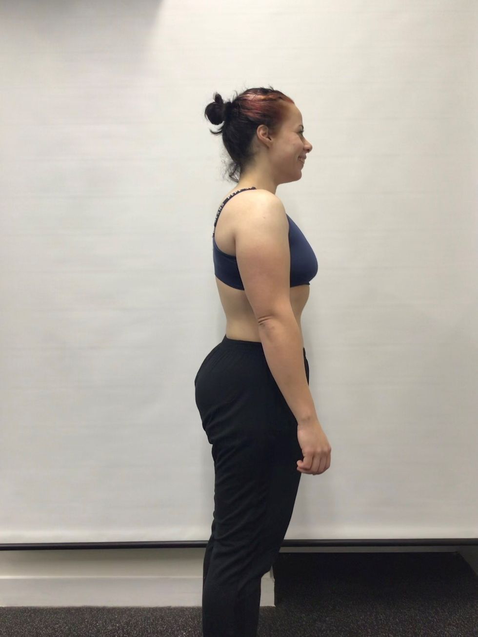 After weight loss