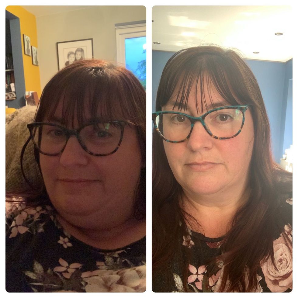 Angie face before and after