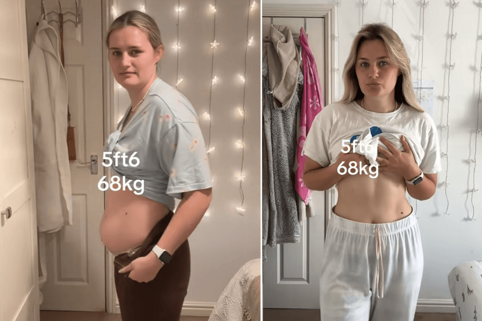 Annie shared before and after pictures from her 'self-improvement journey'
