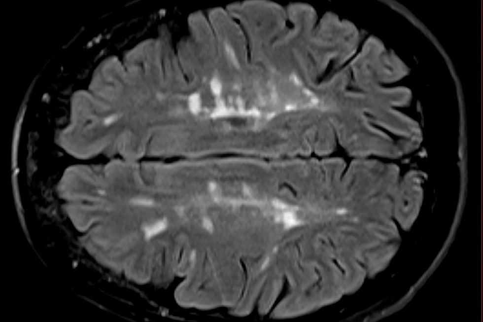 BRAIN SCAN