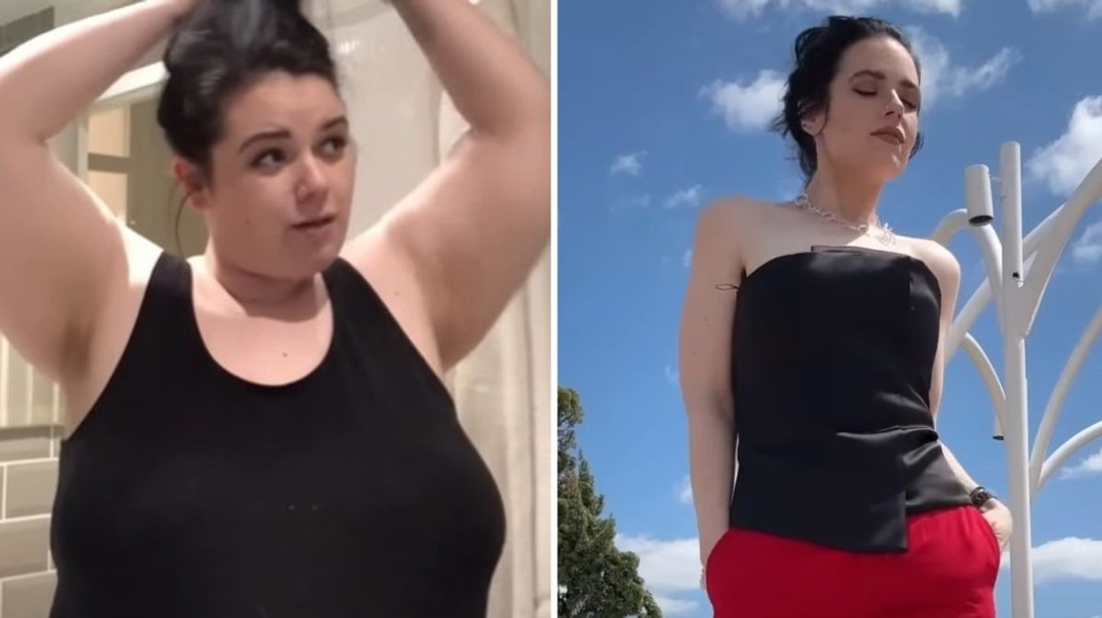Carla before and after pics