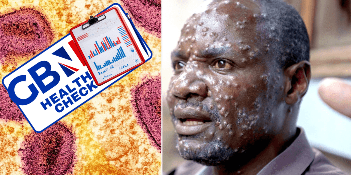 GBN Health Check: How worried should you be about mpox? Virologists weigh in on the global health emergency