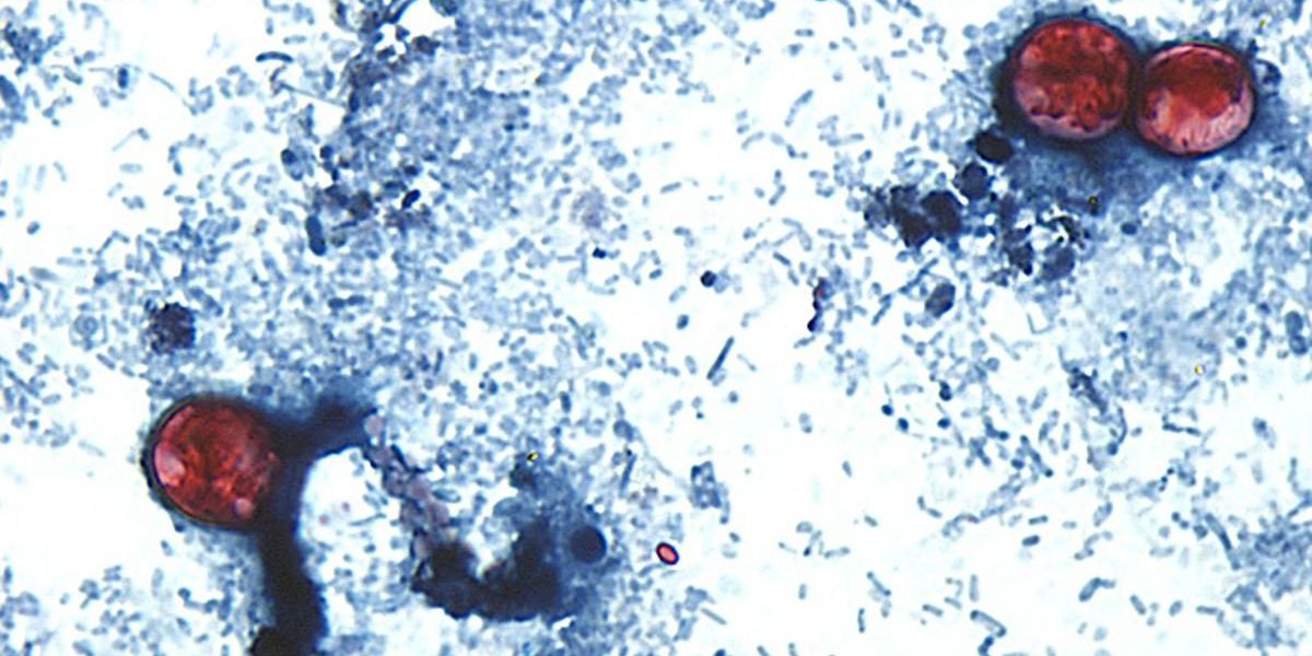 One in three Britons hit by travel bug as cyclosporiasis outbreak turns deadly in the US