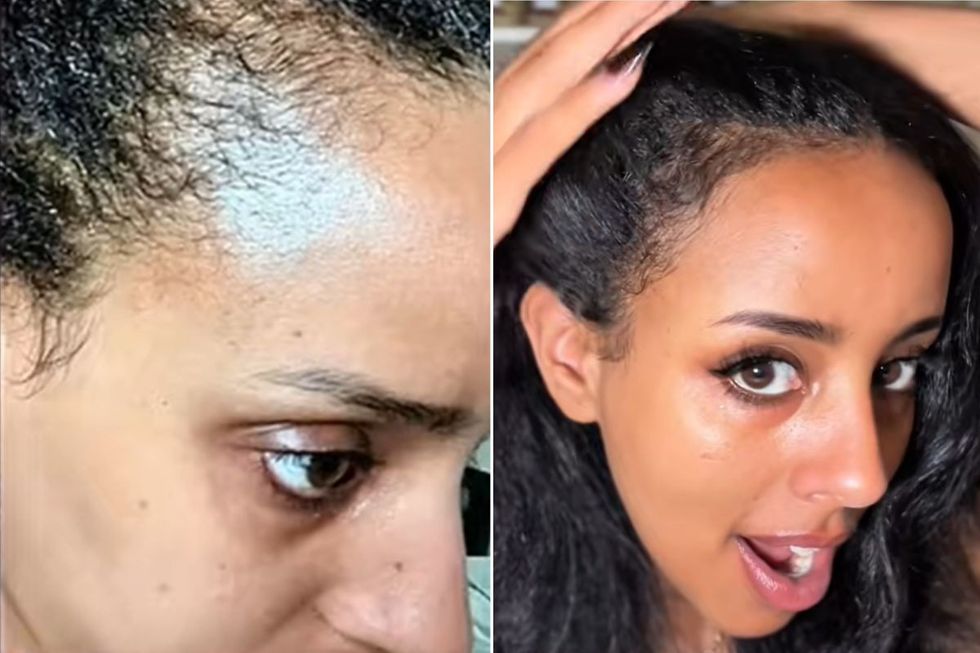 DANIELLA BEFORE AND AFTER