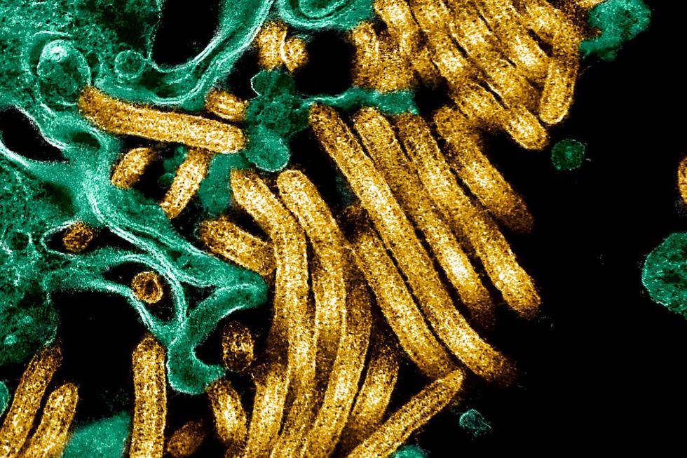 Ebola