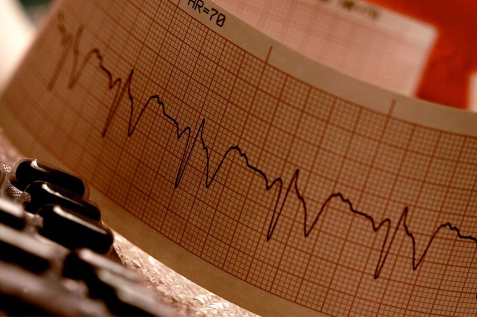 ECG PRINT