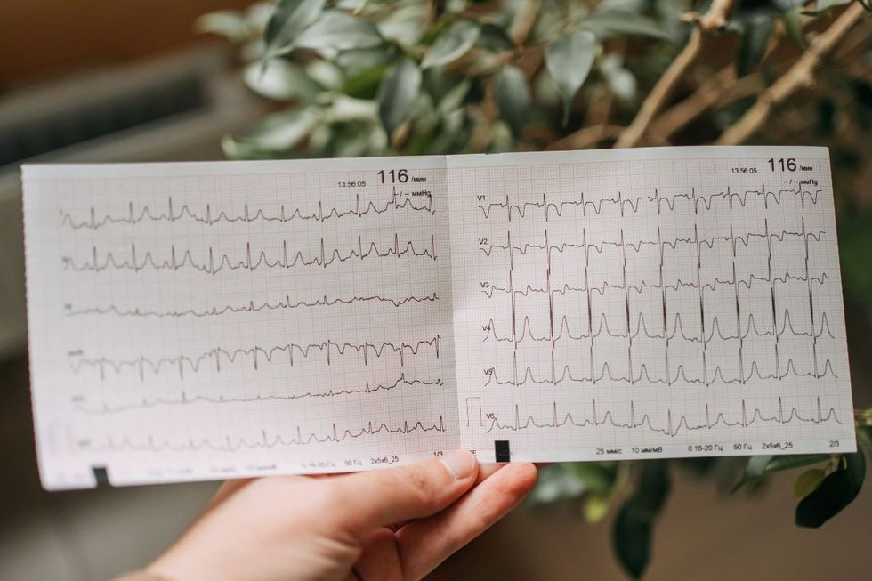 ECG SCRIPT