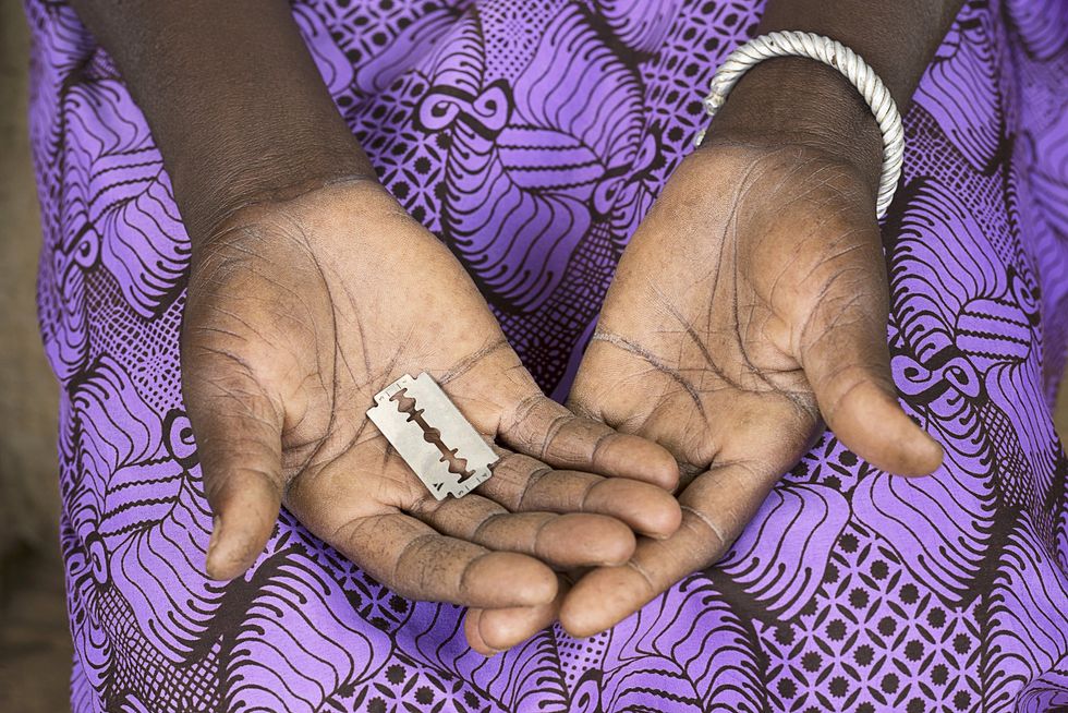 FGM