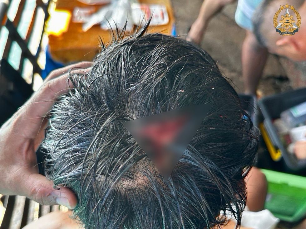 Filipino sailor suffers head injury