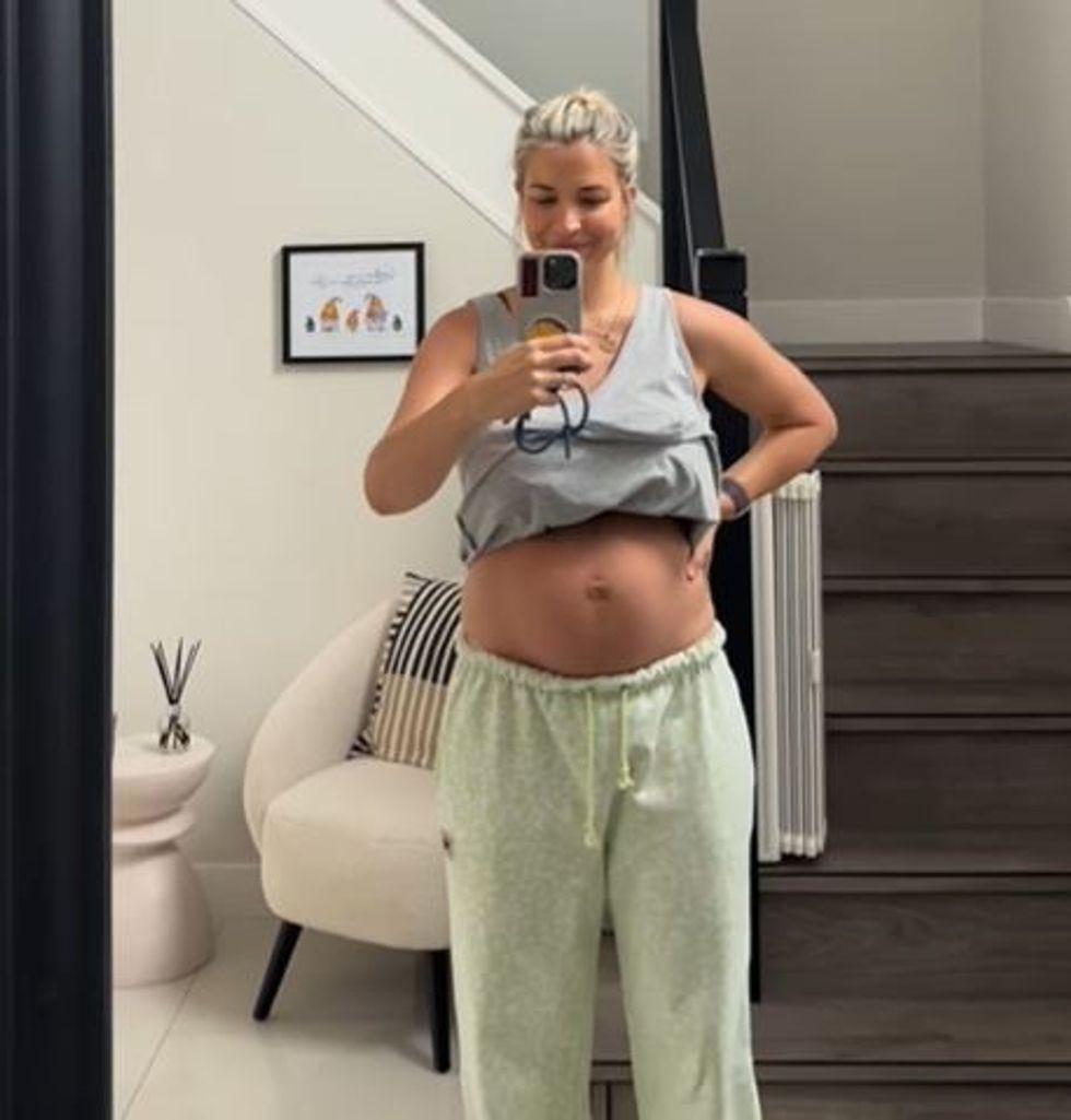 Gemma Atkinson shows her stomach