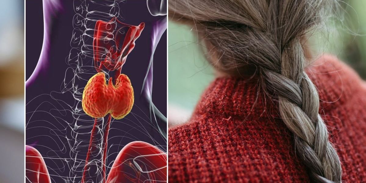 Professor shares surprising thyroid issue behind premature greying - and what you can do to fix it