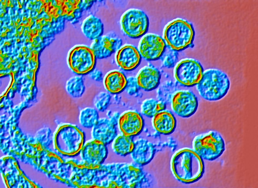 HANTAVIRUS UNDER MICROSCOPE