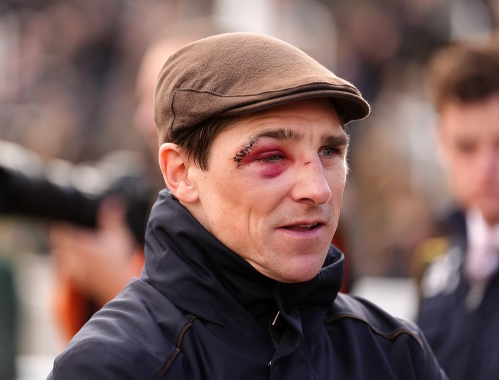 Harry Skelton