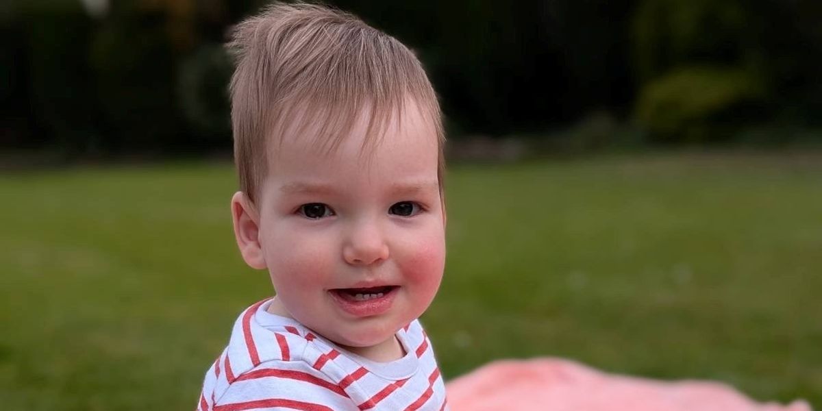 'Cheeky' one-year-old baby boy with rare skull condition successfully undergoes world-first surgery