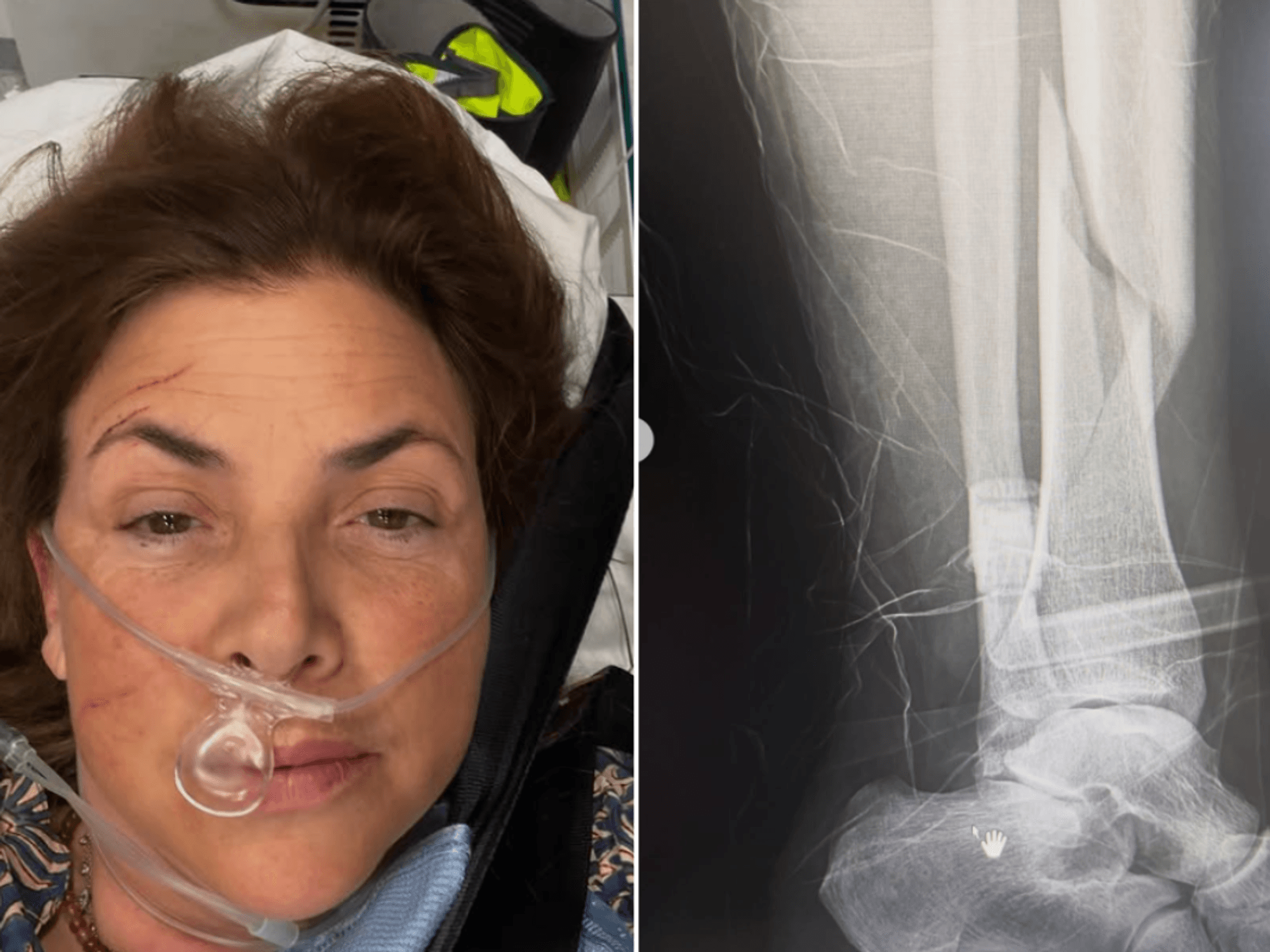 Kirstie Allsopp rushed to hospital by air ambulance and undergoes surgery after horror birthday fall