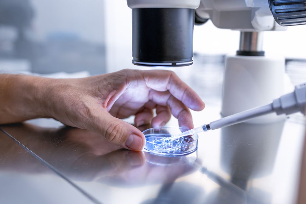 IVF embryo