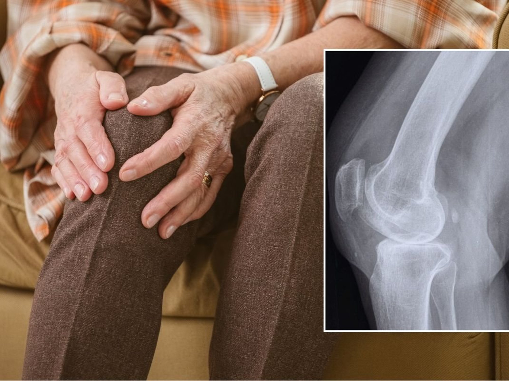 KNEE PAIN AND BONE SCAN