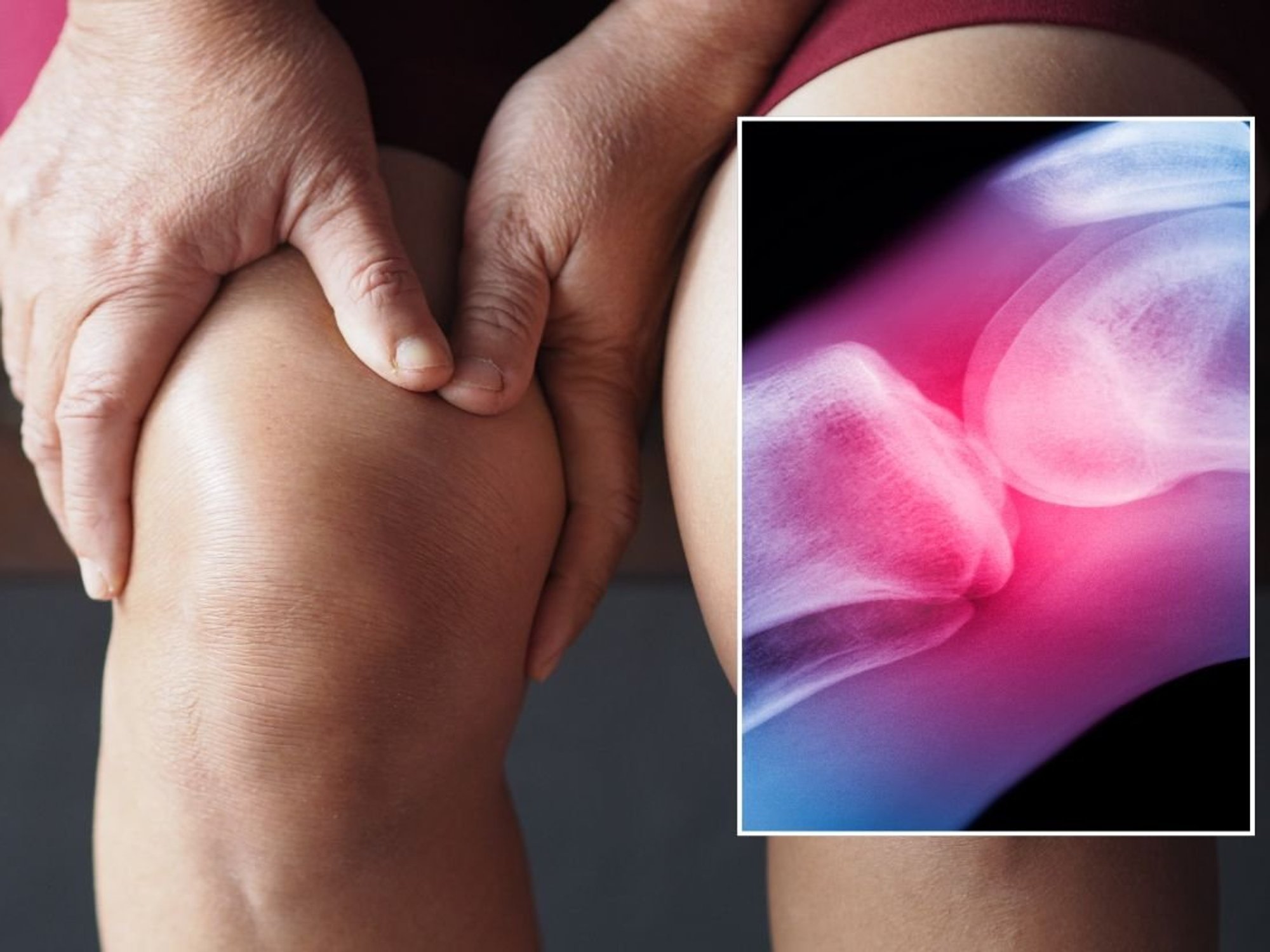 KNEE PAIN