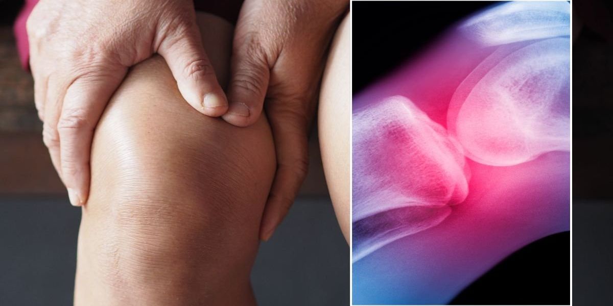 Ice or heat? Pain specialist reveals how to tell which one your arthritis actually needs
