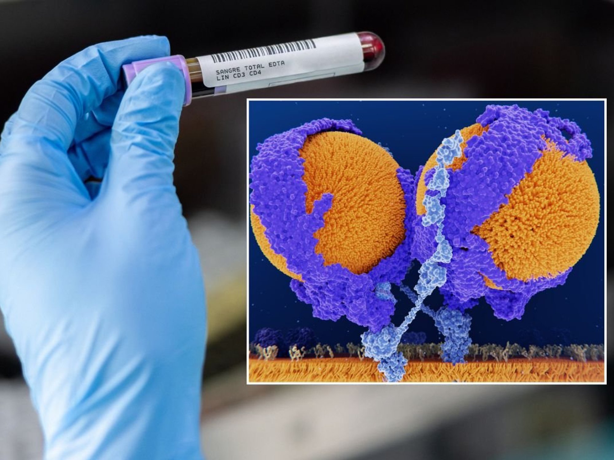 LDL CHOLESTEROL
