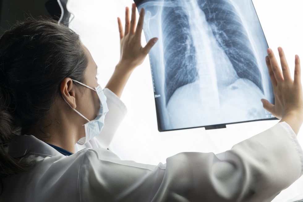 Lung cancer patient scan