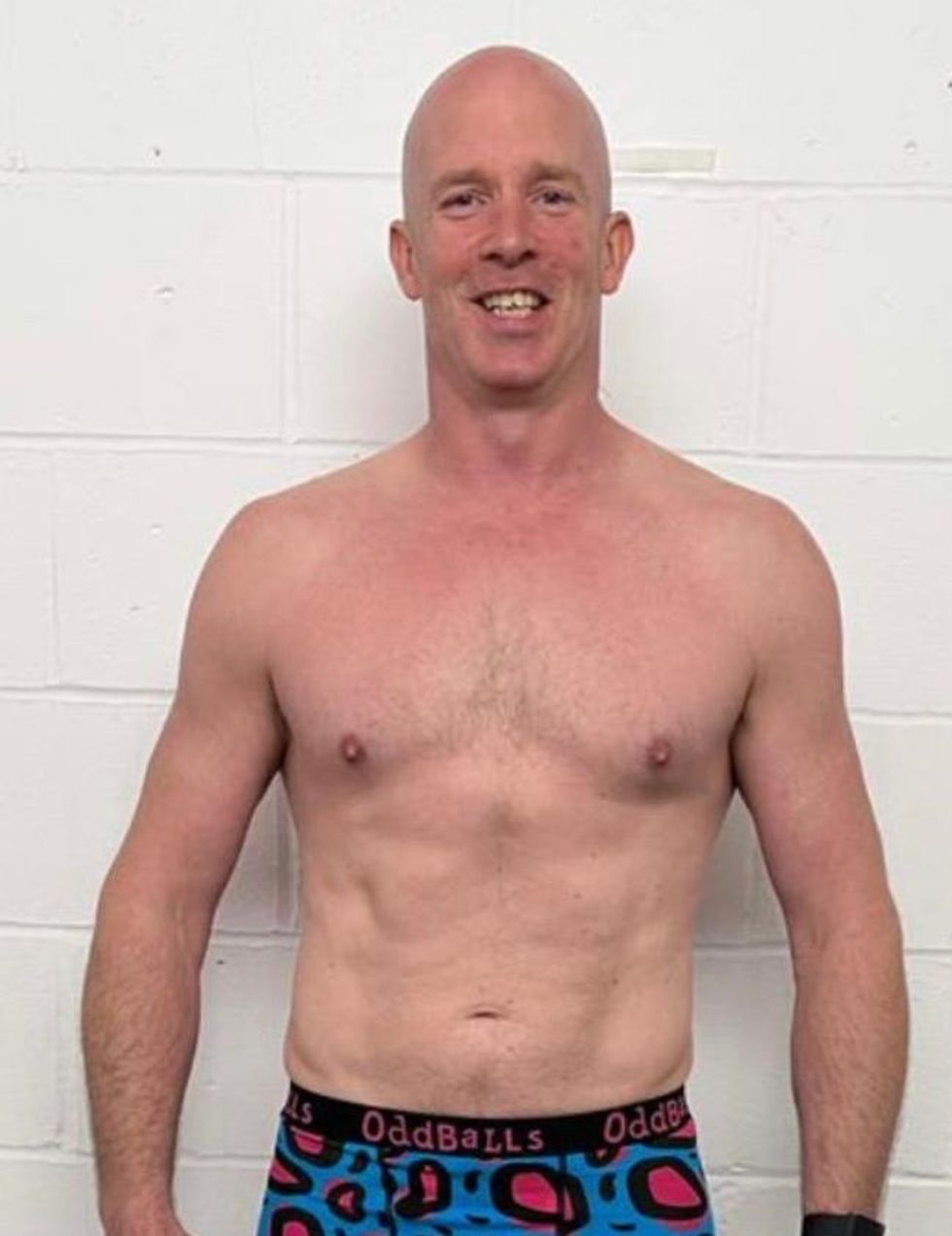 Man after weight loss