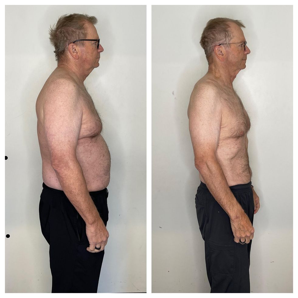 Man before after weight loss