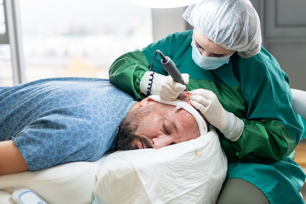 Man undergoing hair transplant
