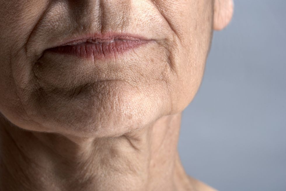 Mature woman with marionette lines
