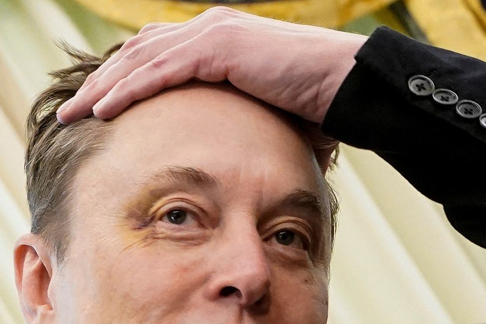Musk shows a bruised eye