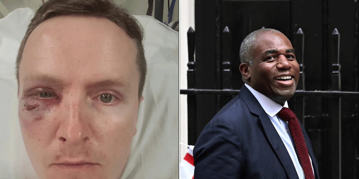Police Federation's warning ignored after attacker who broke officer's leg released after just 82 days