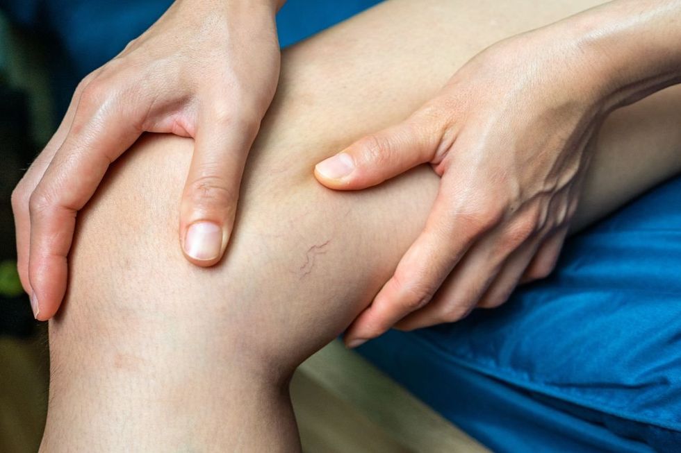 PERSON RUBBING LEG