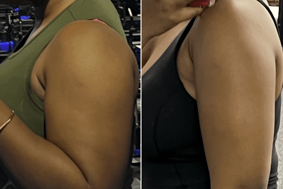Relah Winde shared her before and after pictures, sharing her progress