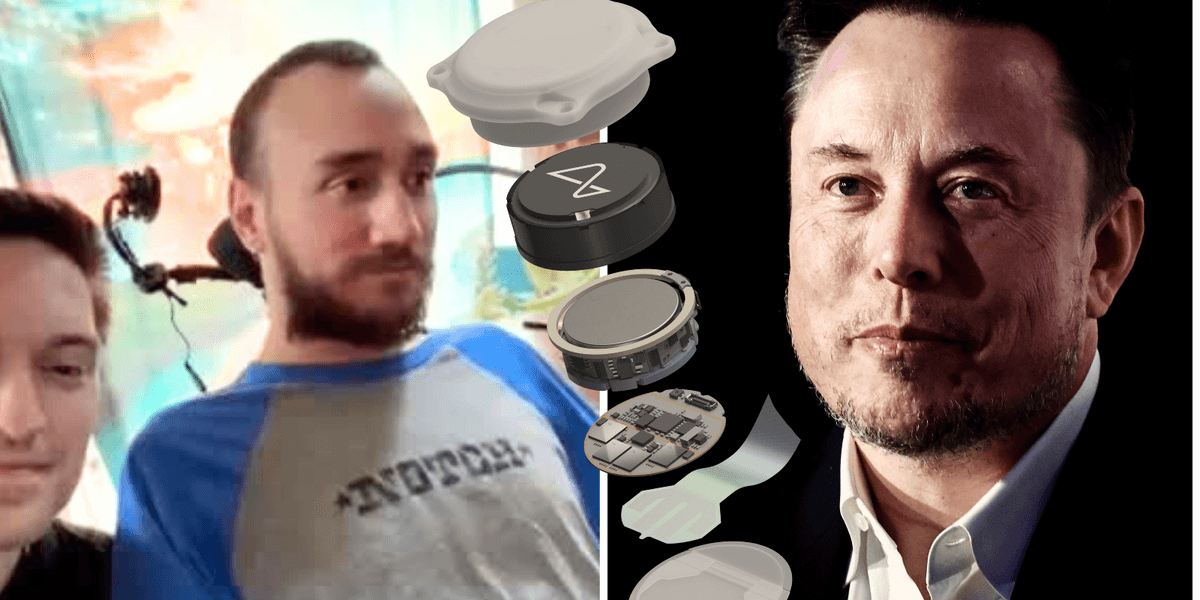 First patient with Elon Musk's brain-chip can play chess by thinking, but admits Neuralink has 'some issues'