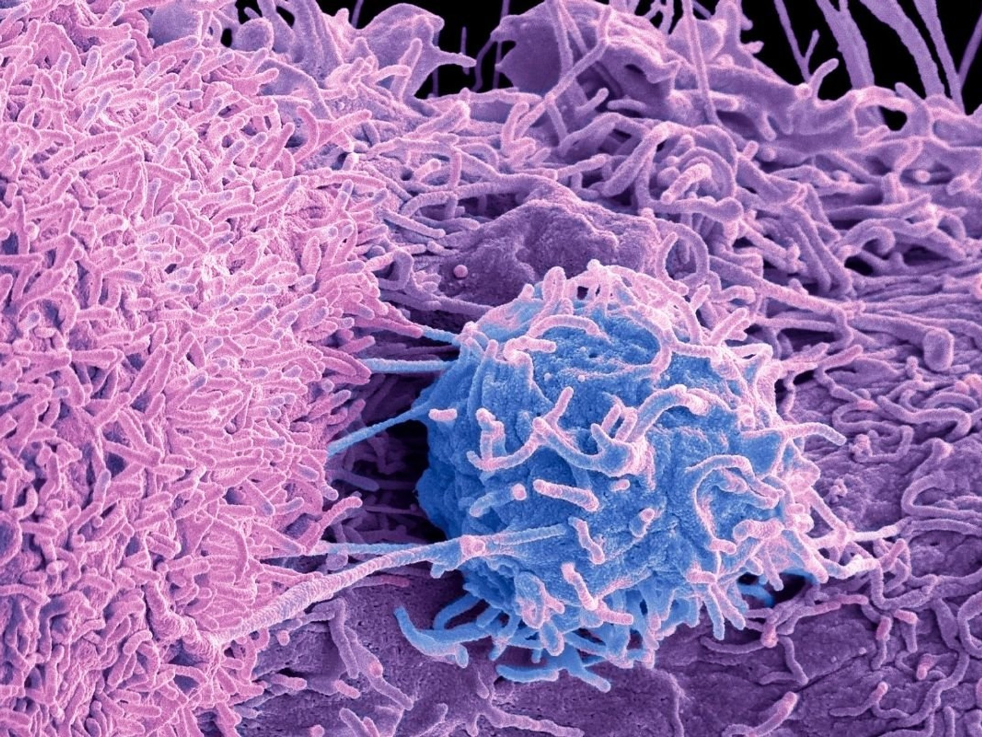 TUMOUR illustration