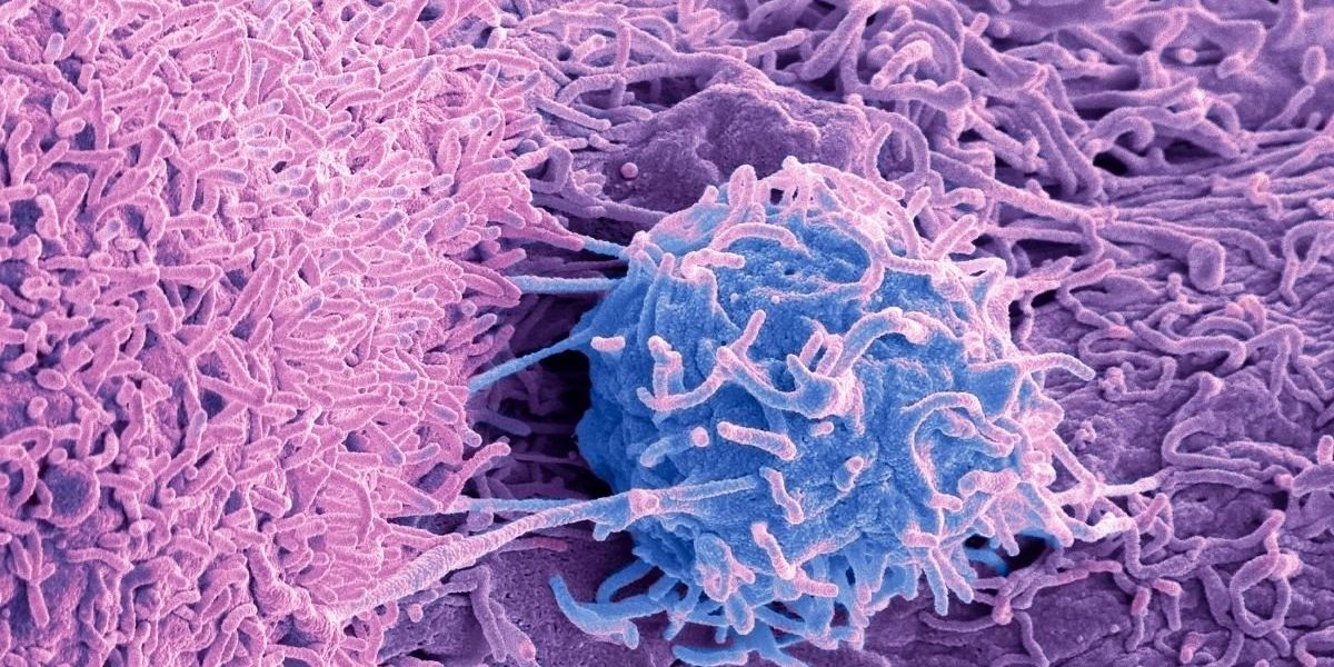 Popular weight loss diet linked to cancer in the small intestine - but only for some people
