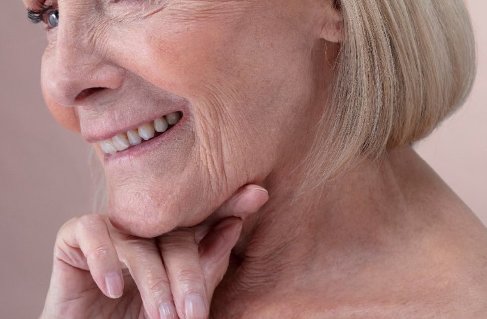 \u200bFacial ageing
