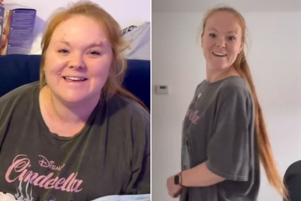 Weight loss