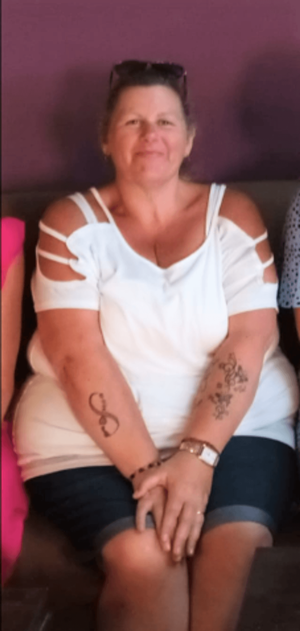 Woman before losing weight