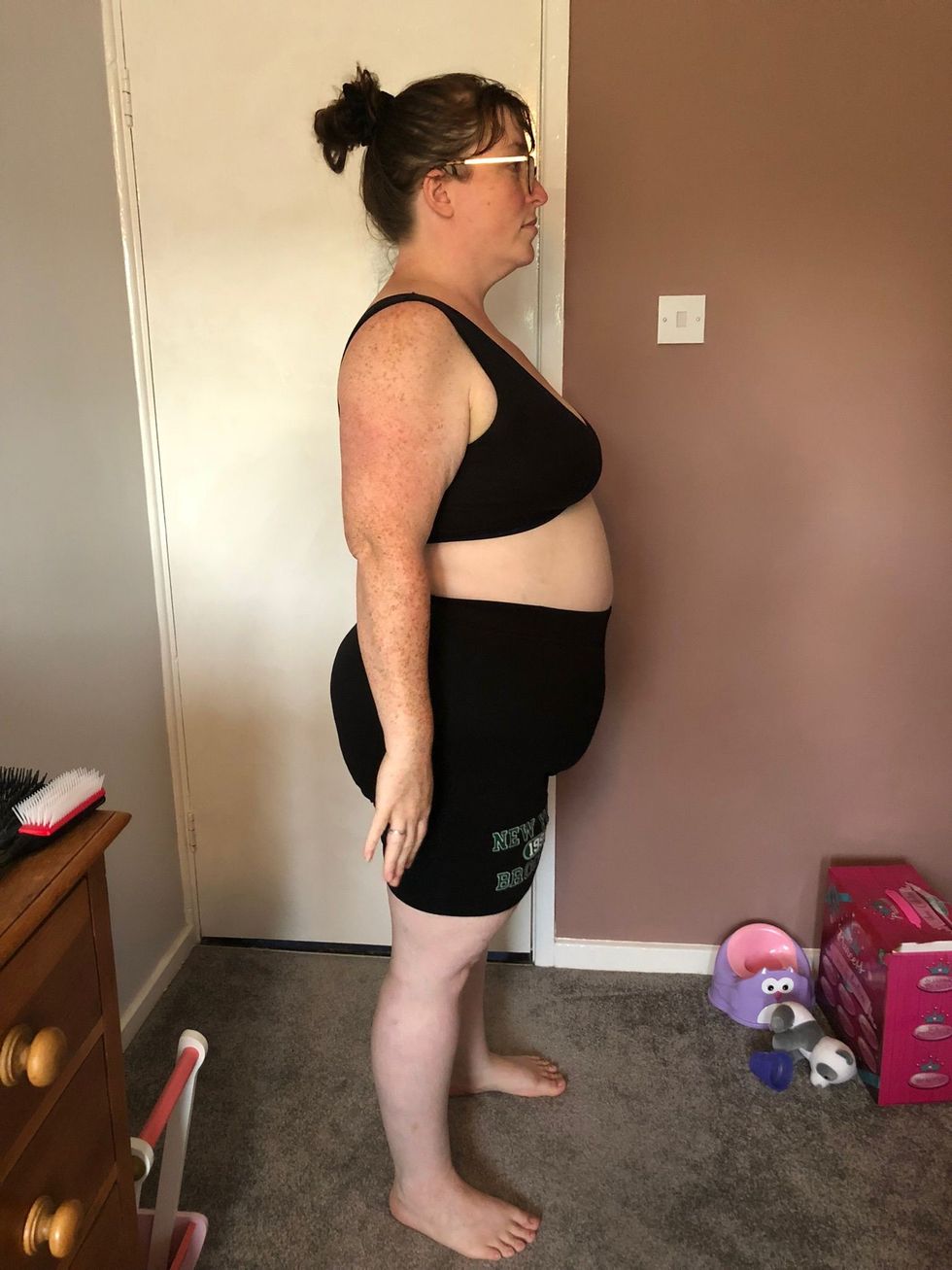 Woman before weight loss