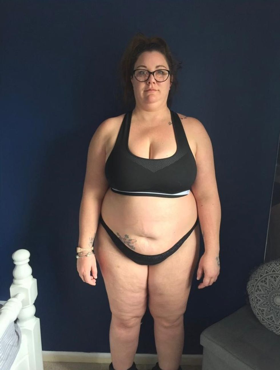 Woman before weight loss
