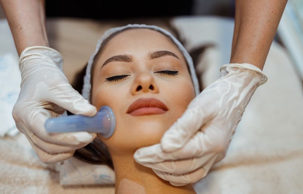 woman cupping